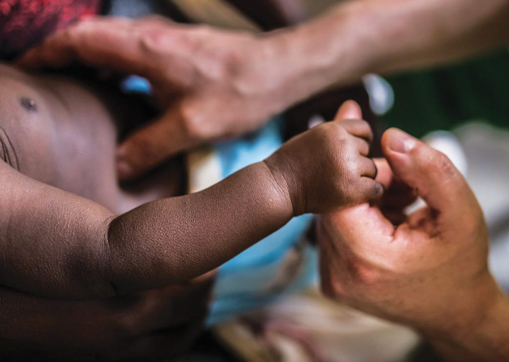Tuberculose infantile : Des chiffres qui donnent froid au dos